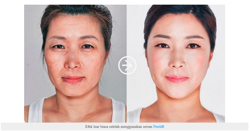 Neolift Serum